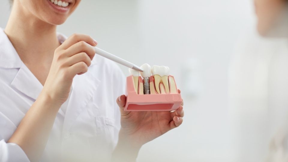 Reasons You Should Consider A Dental Implant