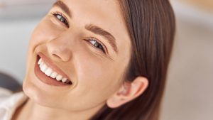 Figuring Out How Many Veneers You Really Need